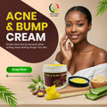 Acne & Bump Cream