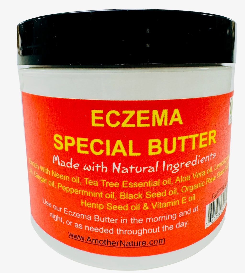 Eczema Butter Special
