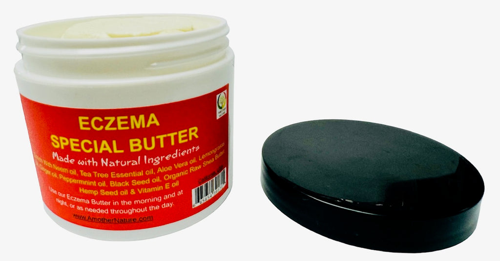 Eczema Butter Special