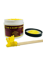 Acne & Bump Cream