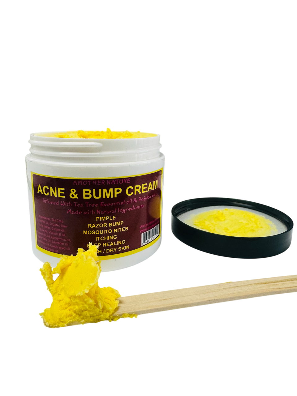 Acne & Bump Cream