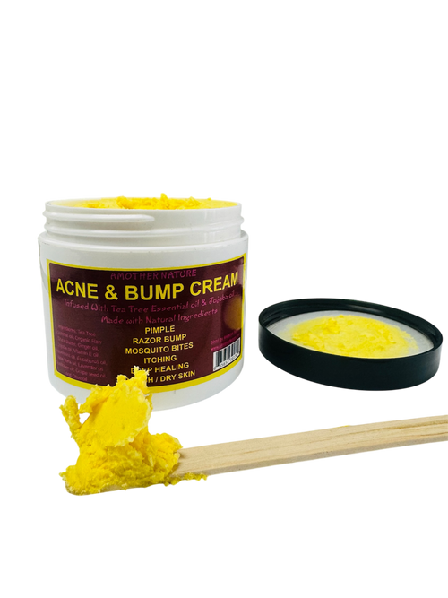 Acne & Bump Cream